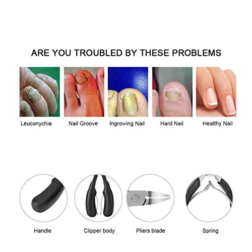 Klješta za nokte od nehrđajućeg čelika kliješta za zanoktice zanoktica pedikir rezač alat za kućnu upotrebu za njegu noktiju za Salon